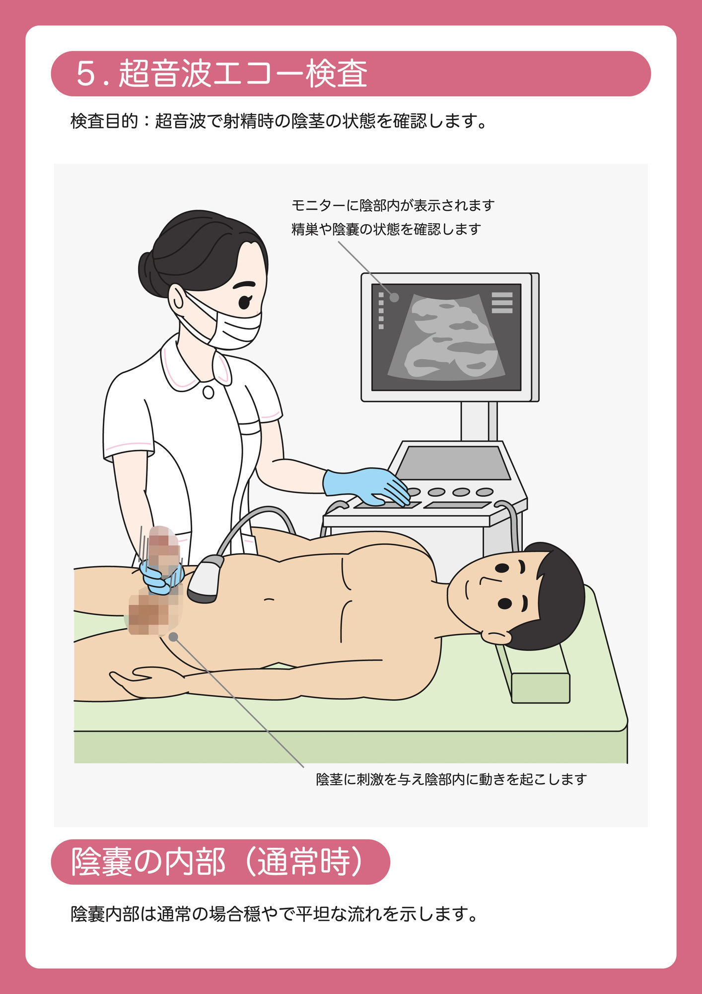 陰茎健診のご案内 サンプル6ページ目