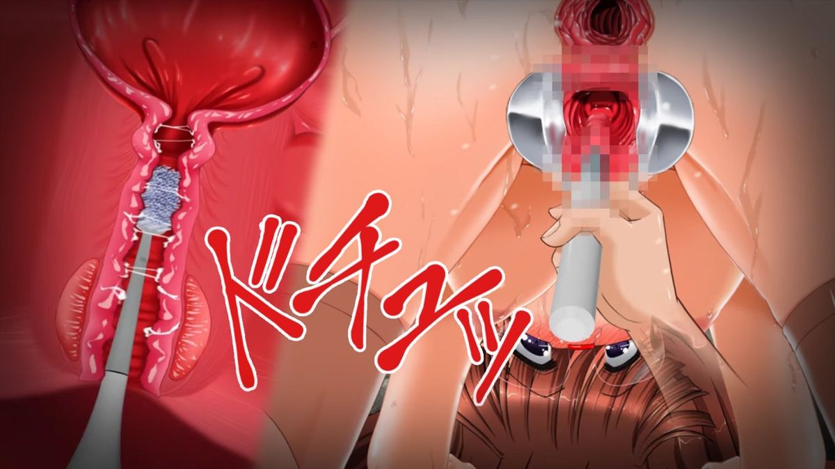 肉奴●志願〜100日間の拡張調教〜アニメーション全集 サンプル8ページ目
