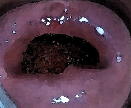 私の蟲姦遊び 17 話 妊娠中にスズメガのサナギ編 サンプル4ページ目