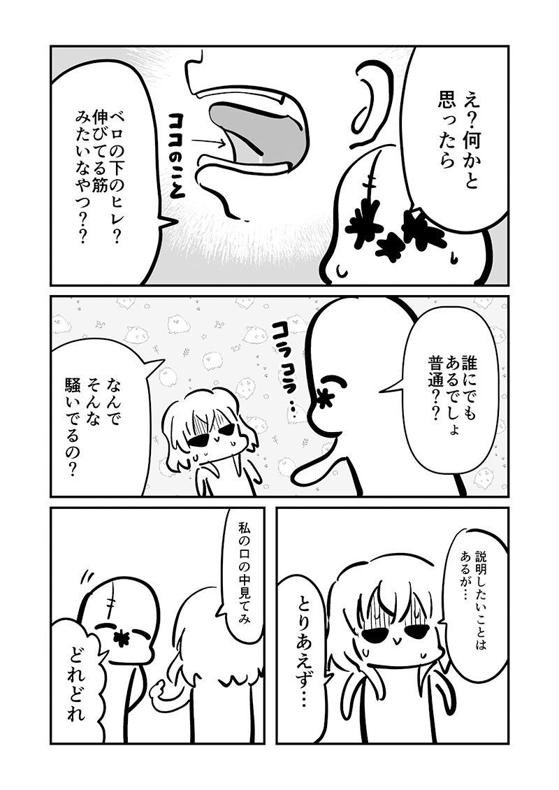 ベロをレーザーで焼いた話1 サンプル6ページ目