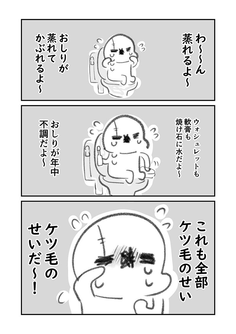 アナルをレーザーで焼いた話  その1 サンプル2ページ目