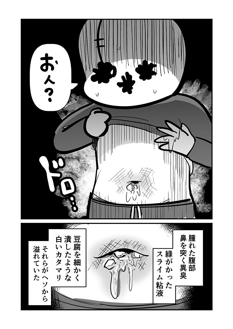 〆切に追われて栄養剤＋仮眠を繰り返していたらおヘソから膿が出て入院した話2 サンプル4ページ目